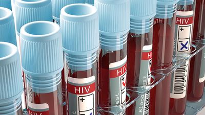 HIV, AIDS, virus